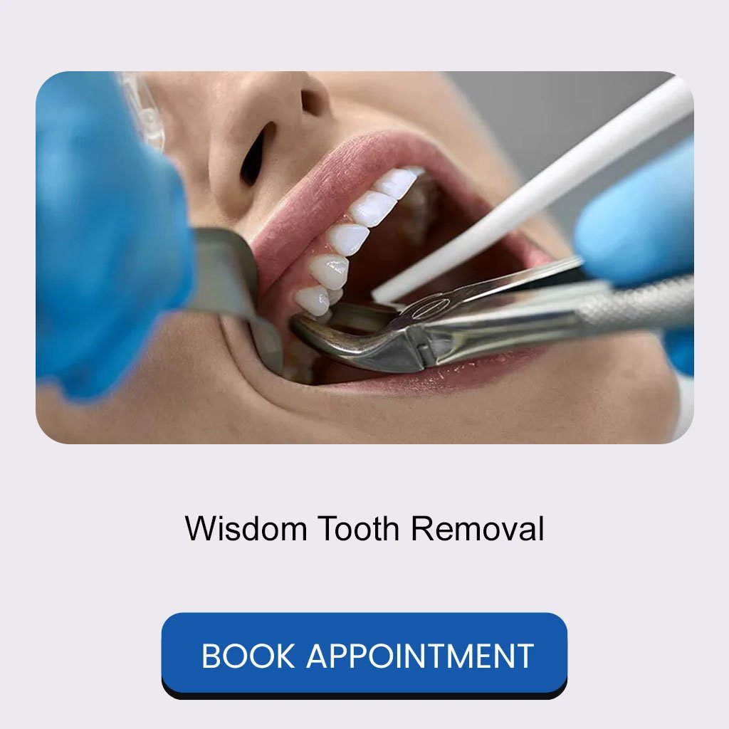 04 Wisdom Tooth Removal