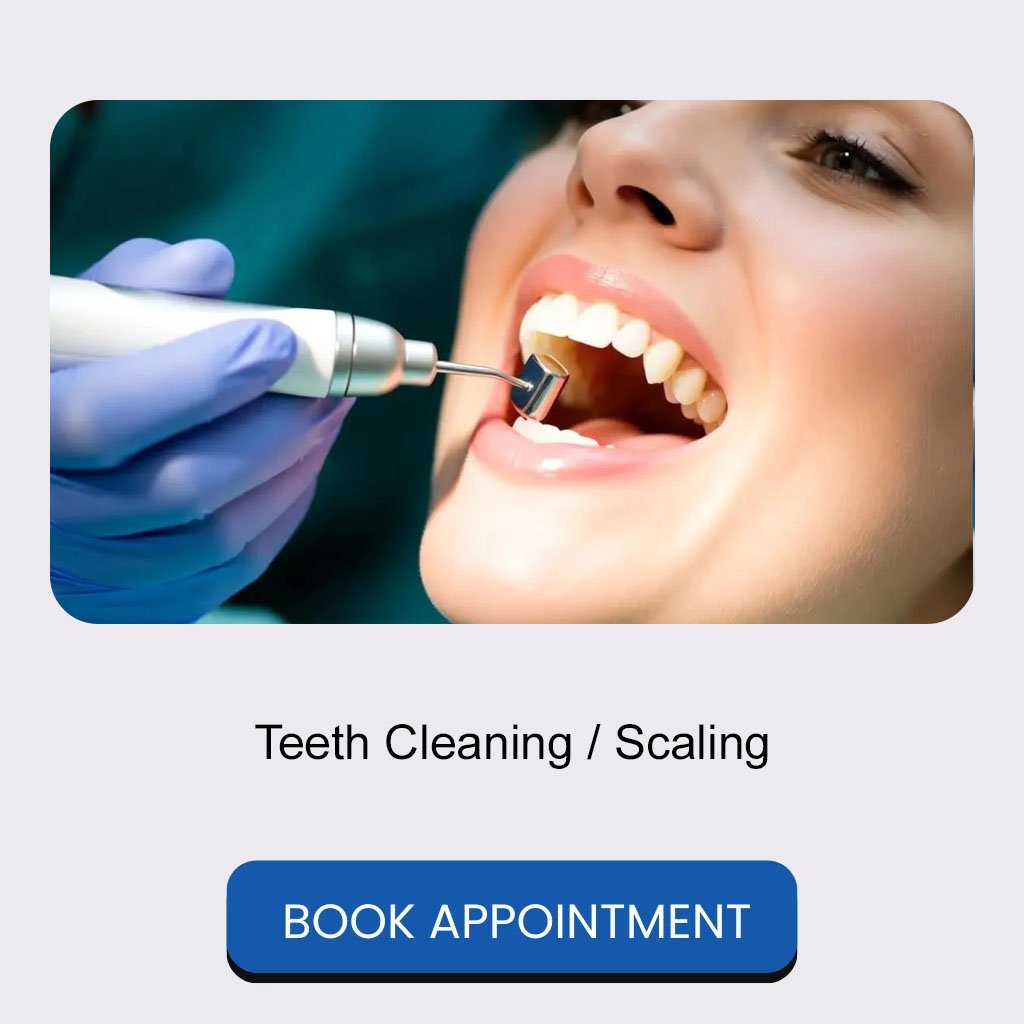 05 Teeth Cleaning